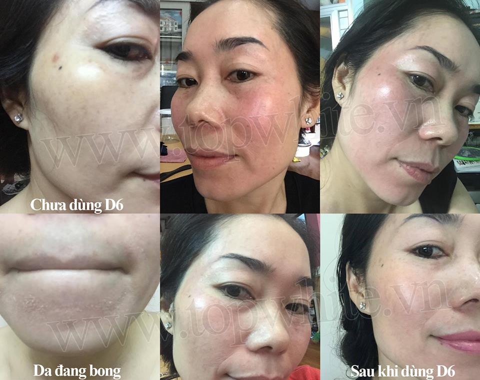 Mỹ phẩm Top White