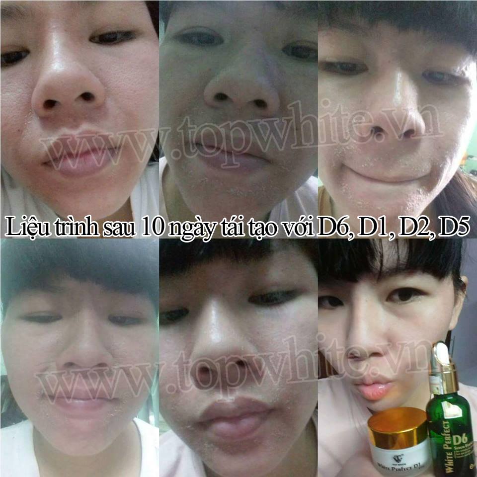 Mỹ phẩm Top White