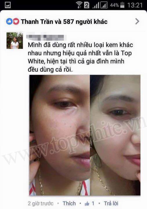 Mỹ phẩm Top White