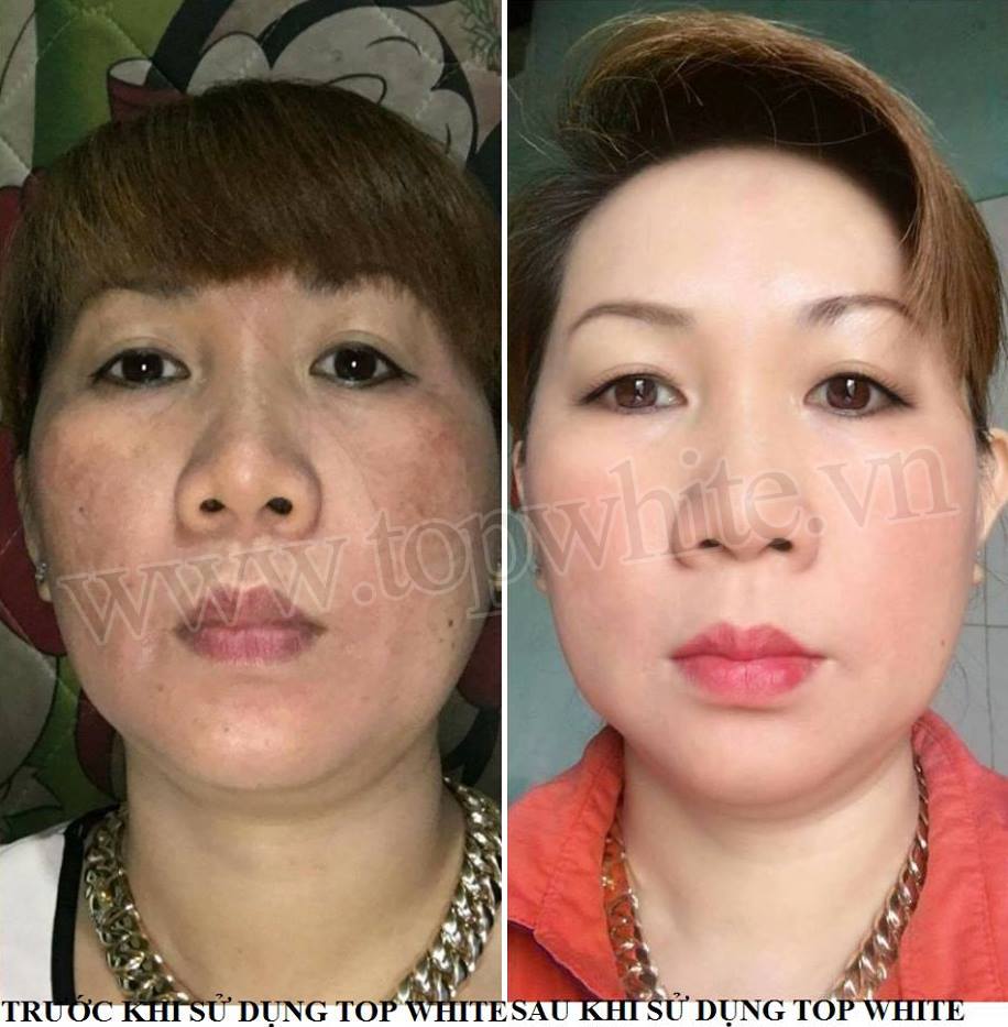 Mỹ phẩm Top White