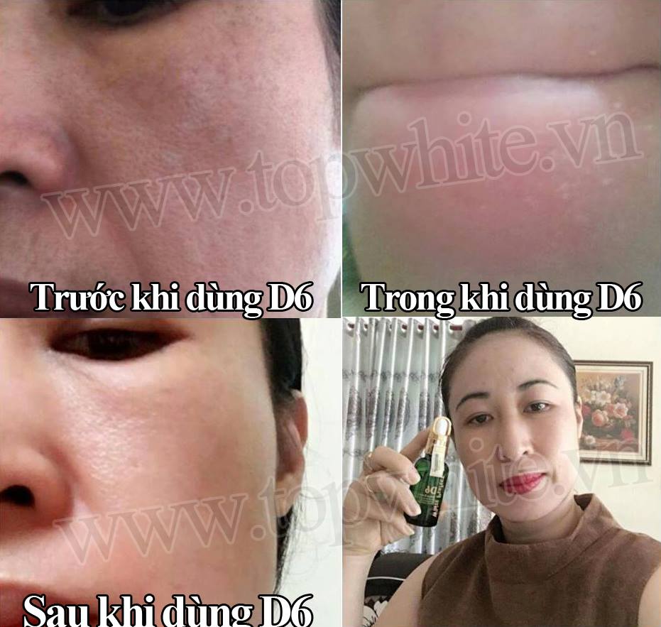 Mỹ phẩm Top White