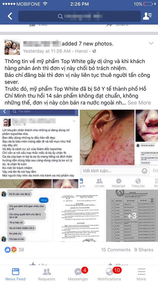Mỹ phẩm Top White