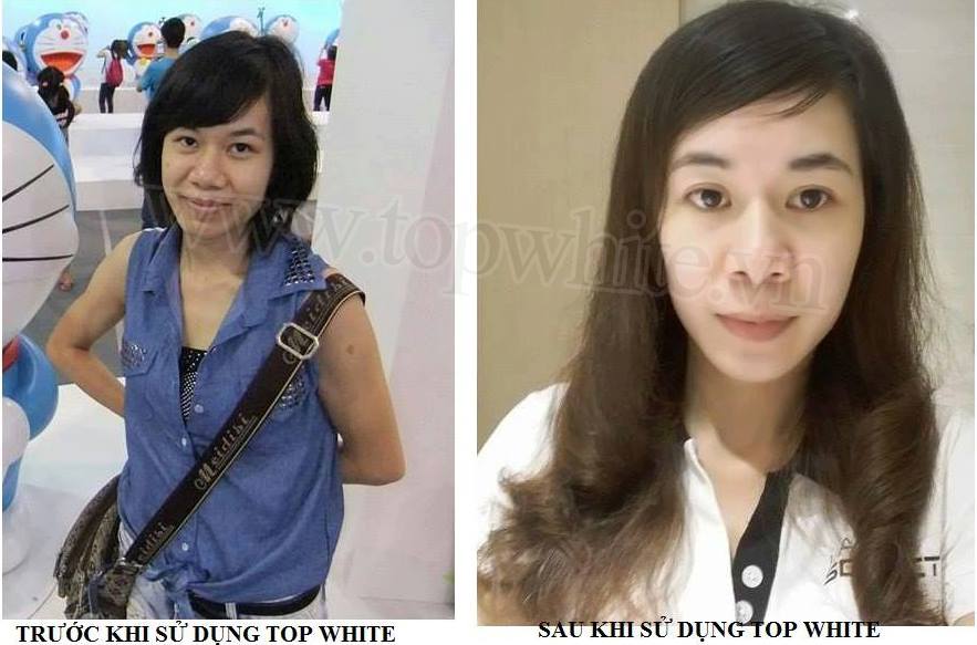 Mỹ phẩm Top White