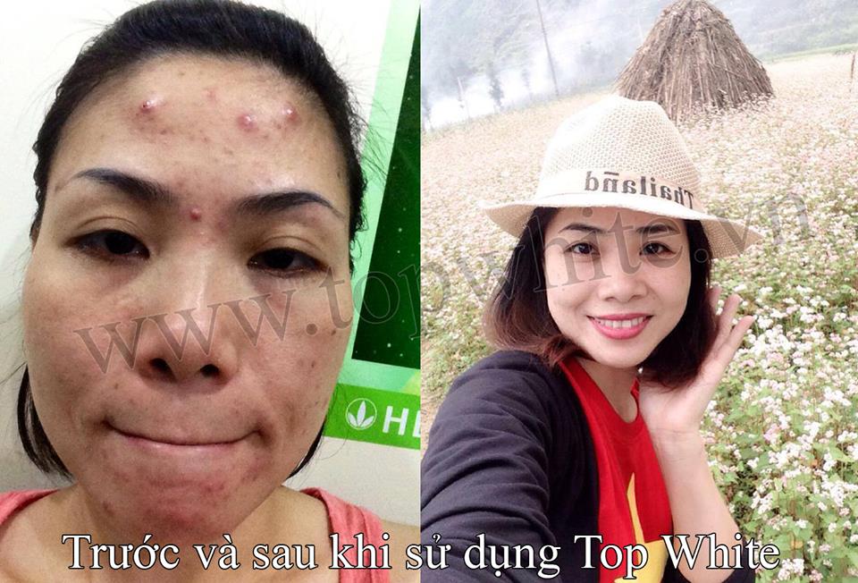 Mỹ phẩm Top White