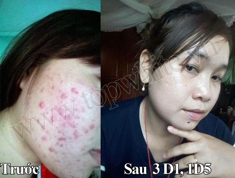 Mỹ phẩm Top White