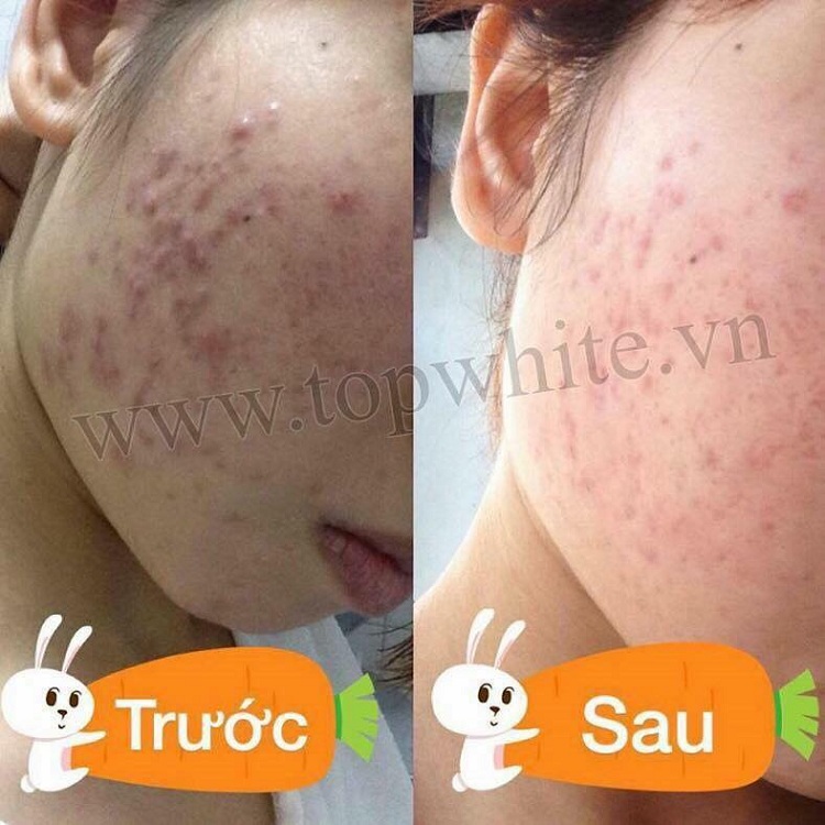 Mỹ phẩm Top White