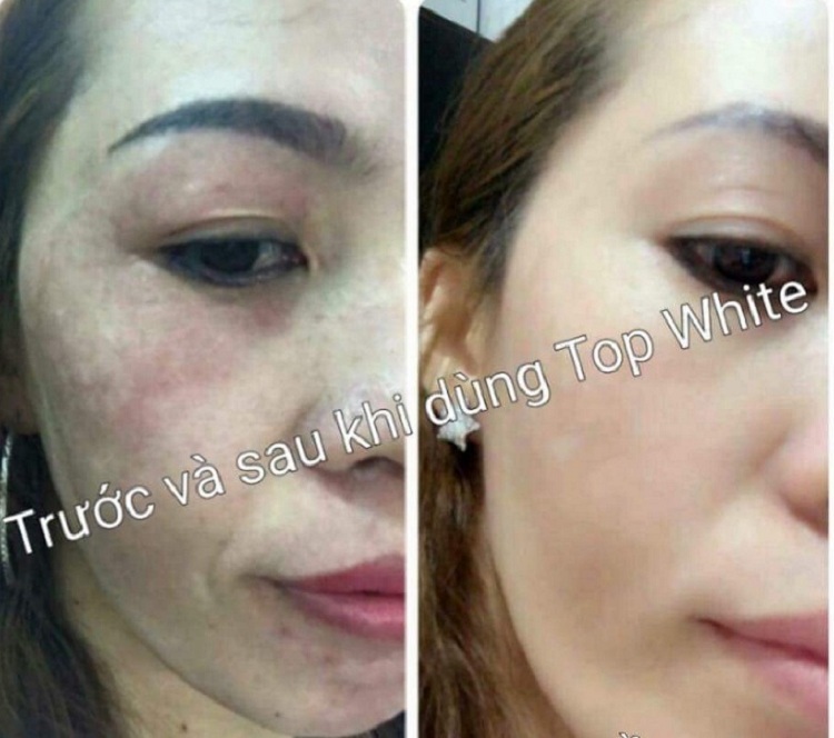 Mỹ phẩm Top White