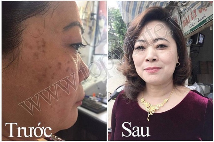 Mỹ phẩm Top White