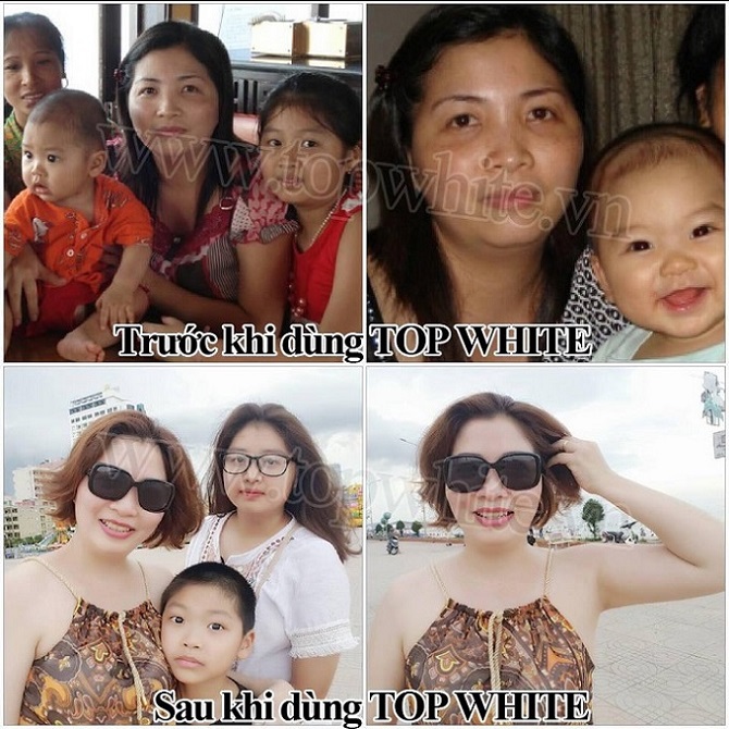 Mỹ phẩm Top White