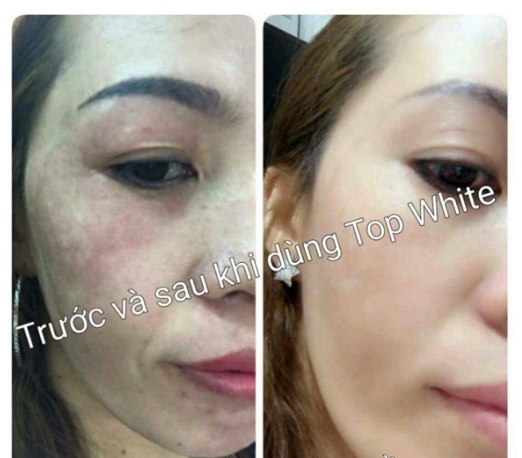 Mỹ phẩm Top White