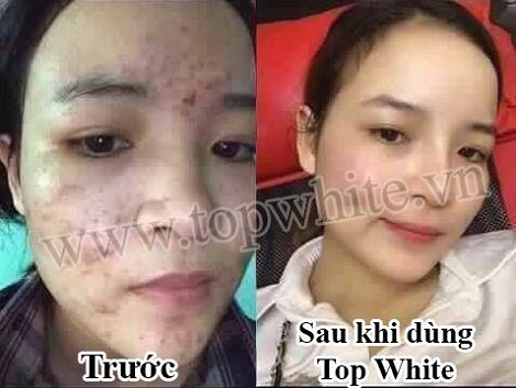 Mỹ phẩm Top White